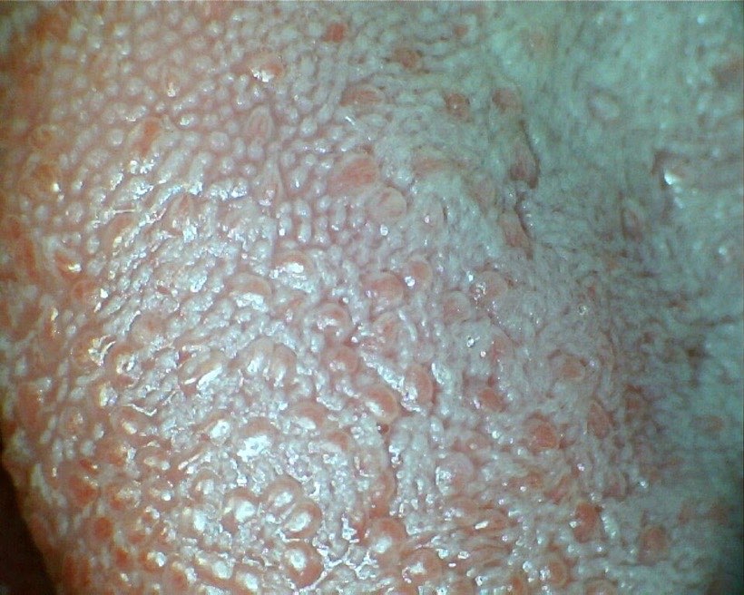 Your tongue is covered in tiny bumps that hold taste buds.