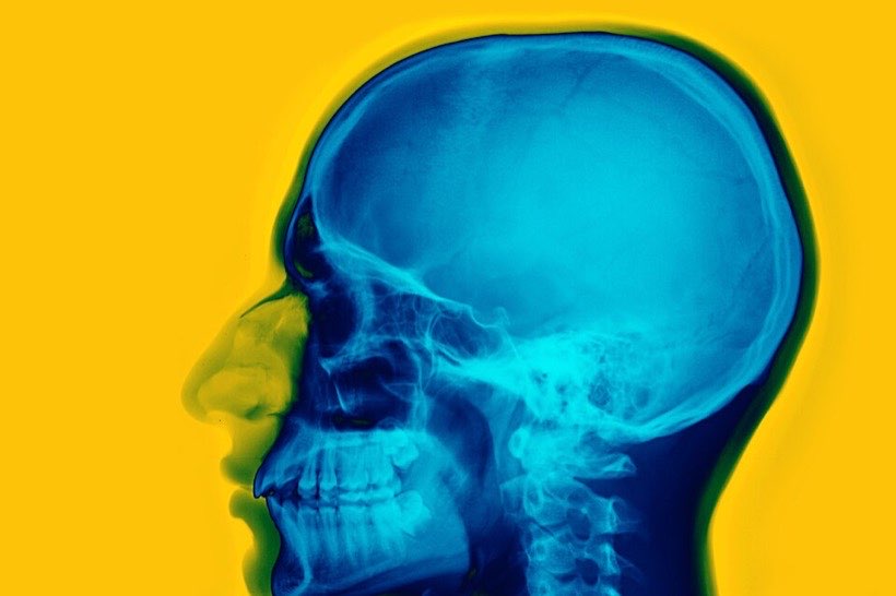 Explore the bones of the body in the Inside My Body lab.